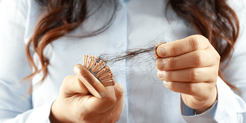 hair loss