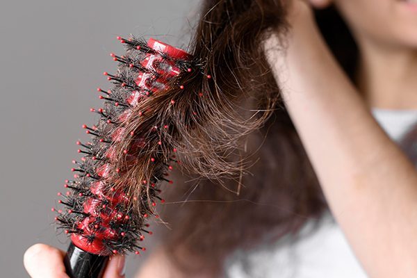 Root Causes of Hair Loss