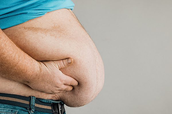 treatments for Obesity