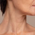 Remedies for Dark Neck