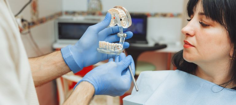 dental implants benefits