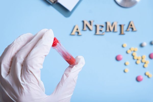 Simple Guide for Symptoms, Causes, and Cures of Anemia Anemia