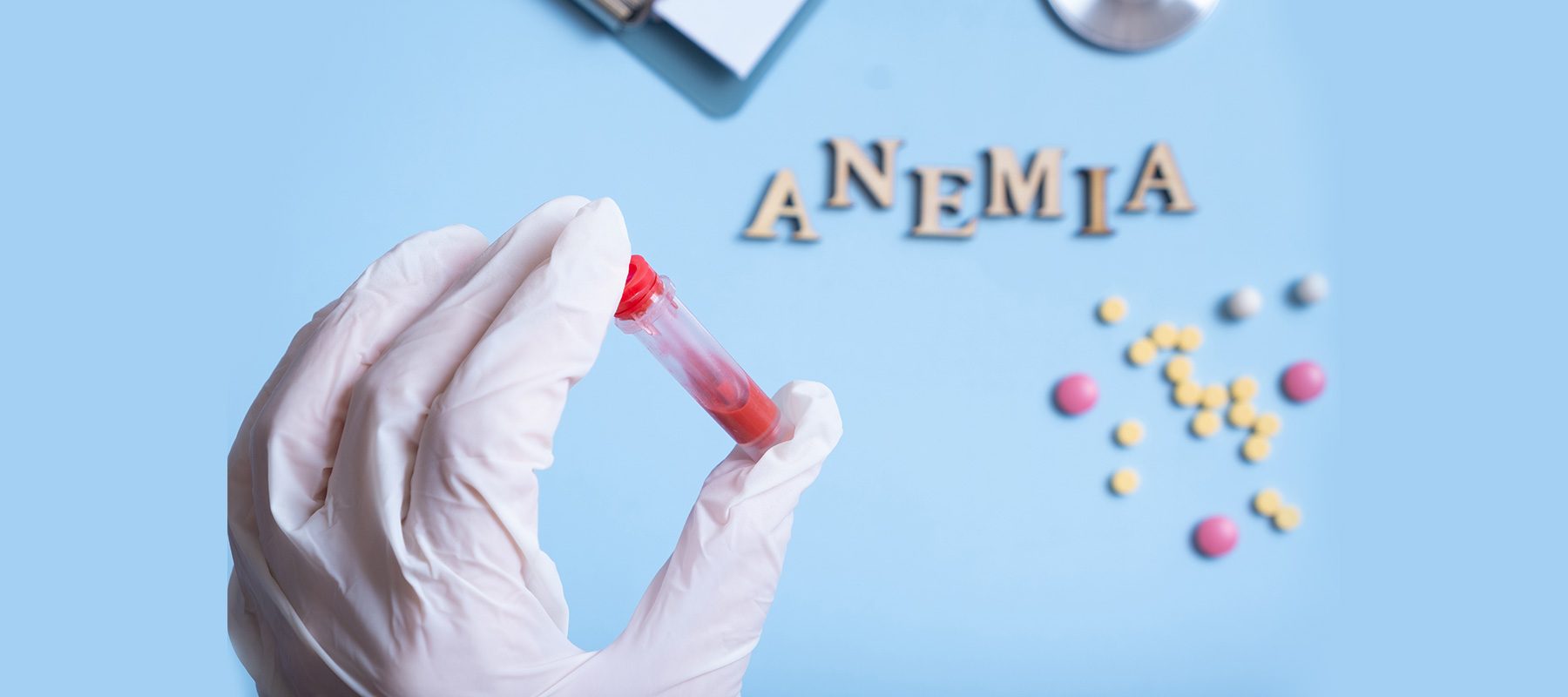 Anemia