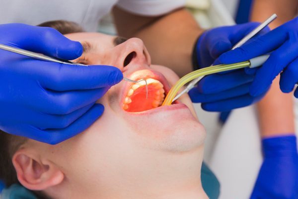 Best Simple Tips For Speedy Recovery After Wisdom Teeth Removal Wisdom teeth removal