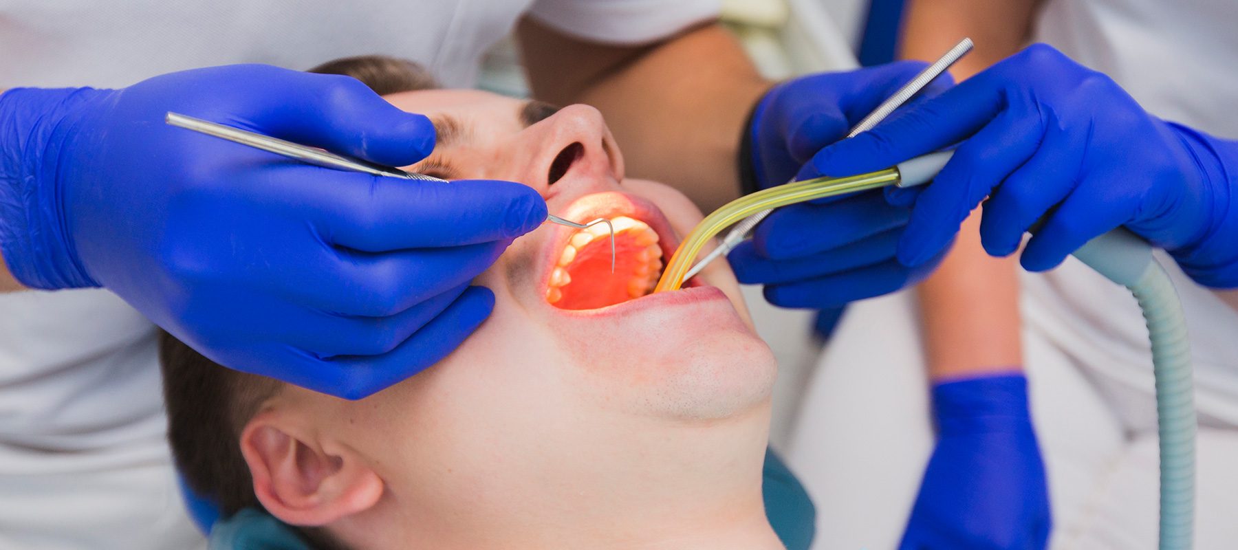 Wisdom teeth removal